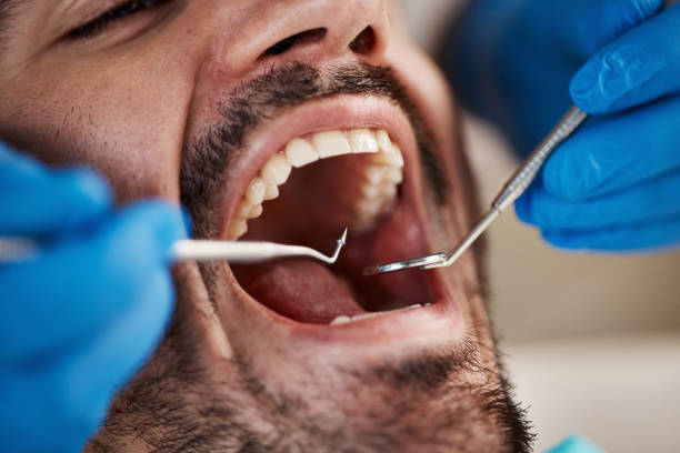 Best Emergency Tooth Extraction in South Patrick Shores, FL